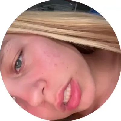 Rusacarabanchel Flashes The Camera